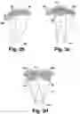 Fig. 04 - Operating table lamp