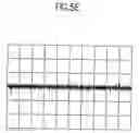 Fig. 08 - Method of recording and reproducing an optical recording medium