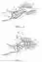 Fig. 04 - Semi-permanent canal hearing device