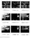 Fig. 09 - Method and apparatus for error concealment for JPEG 2000 compressed images and data block-based video data