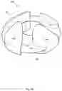 Fig. 22 - Rotary blood pump and control system therefor