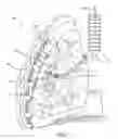 Fig. 08 - Methods and devices for blocking flow through collateral pathways in the lung