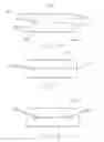 Fig. 03 - Methods for whitening teeth