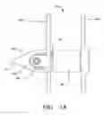 Fig. 02 - Bioresorbable interspinous process implant for use with intervertebral disk remediation or replacement implants and procedures