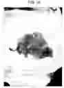Fig. 02 - Particulate cartilage compositions, processes for their preparation and methods for regenerating cartilage