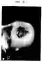 Fig. 03 - Particulate cartilage compositions, processes for their preparation and methods for regenerating cartilage
