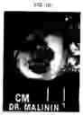 Fig. 05 - Particulate cartilage compositions, processes for their preparation and methods for regenerating cartilage