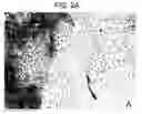 Fig. 06 - Particulate cartilage compositions, processes for their preparation and methods for regenerating cartilage