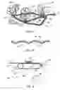 Fig. 08 - Loop materials