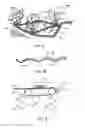 Fig. 08 - Embossing loop materials
