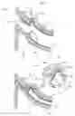 Fig. 04 - Joint structure for partial foaming part of instrument panel