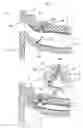 Fig. 11 - Joint structure for partial foaming part of instrument panel
