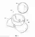 Fig. 02 - Placement device for installing a pellet-retention device onto a tooth