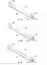 Fig. 04 - Placement device for installing a pellet-retention device onto a tooth
