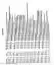 Fig. 09 - Determination of hepatitis C virus genotype