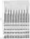 Fig. 28 - Characterization of CYP 2D6 genotypes