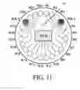 Fig. 11 - Self-contained microfluidic biochip and apparatus