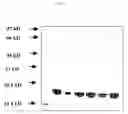 Fig. 05 - Stable gene variants of lipases