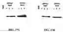 Fig. 45 - β-secretase enzyme compositions and methods