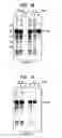 Fig. 06 - Modified chitin-binding domain and use thereof