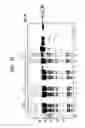 Fig. 08 - Modified chitin-binding domain and use thereof