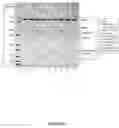Fig. 08 - Methods of adenovirus purification