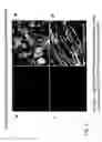 Fig. 07 - Induction and high-yield preparative purification of mesencephalic dopaminergic neuronal progenitor cells and dopaminergic neurons from human embryonic stem cells