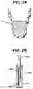 Fig. 04 - Failure detection in automated clinical analyzers