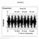 Fig. 07 - Method for determining the quality of a communication channel
