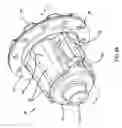 Fig. 03 - Helical gear differential