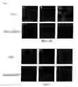 Fig. 04 - siRNA expression system and method for producing functional gene knock-down cell using the system