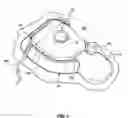 Fig. 04 - Passive vibration isolation of implanted microphone