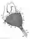 Fig. 01 - Delivery of cardiac constraint jacket