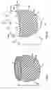 Fig. 05 - Delivery of cardiac constraint jacket