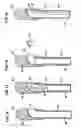 Fig. 12 - Delivery of cardiac constraint jacket