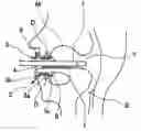 Fig. 01 - Endoscopic mouthpiece