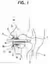 Fig. 02 - Endoscopic mouthpiece