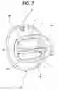 Fig. 08 - Endoscopic mouthpiece