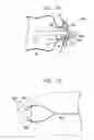 Fig. 10 - Pressure-propelled system for body lumen