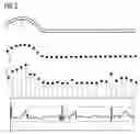 Fig. 03 - Method for endoluminal imaging with movement correction