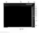 Fig. 05 - Method and system for intelligent qualitative and quantitative analysis of digital radiography softcopy reading