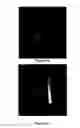 Fig. 06 - Method and system for intelligent qualitative and quantitative analysis of digital radiography softcopy reading
