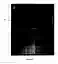 Fig. 07 - Method and system for intelligent qualitative and quantitative analysis of digital radiography softcopy reading