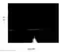 Fig. 08 - Method and system for intelligent qualitative and quantitative analysis of digital radiography softcopy reading