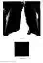 Fig. 22 - Method and system for intelligent qualitative and quantitative analysis of digital radiography softcopy reading
