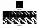 Fig. 23 - Method and system for intelligent qualitative and quantitative analysis of digital radiography softcopy reading