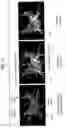 Fig. 04 - Method and system for registration of 3D images within an interventional system