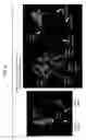 Fig. 05 - Method and system for registration of 3D images within an interventional system