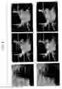 Fig. 06 - Method and system for registration of 3D images within an interventional system