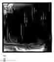 Fig. 07 - Method and system for registration of 3D images within an interventional system
